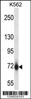 Mouse Pak7 Antibody (N-term)