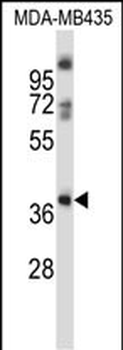 GPR15 Antibody (C-term)