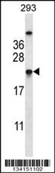 TAGLN2 Antibody (C-term)