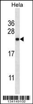 SEC22B Antibody (Center)