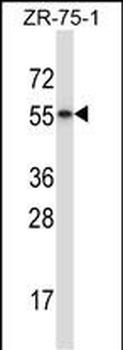 RORB Antibody (C-term)