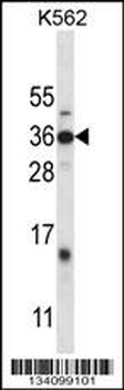 DLX4 Antibody (Center)