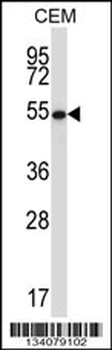 GABPA Antibody (Center)