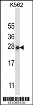 IL22 Antibody (Center)