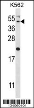 HAVCR1 Antibody (N-term)