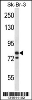 MCM3 Antibody (N-term)
