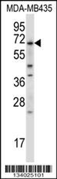 BIRC3 Antibody (N-term)