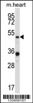 PIAS4 Antibody (N-term)