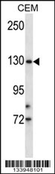 TMPRSS9 Antibody (N-term)