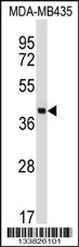 SFTPD Antibody (C-term)