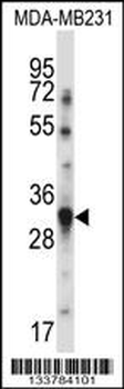 TNFSF13B Antibody (N-term)