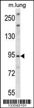 UNC45B Antibody (N-term)