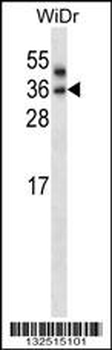 PNPLA4 Antibody (C-term)