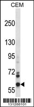 NOX5 Antibody (C-term)