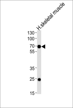 FAM198B Antibody (Center)