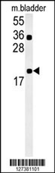 CCDC12 Antibody (N-term)