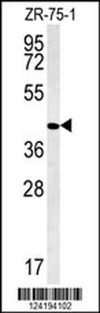 PPAN Antibody (C-term)