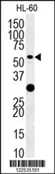 TRAF3 Antibody (C-term)