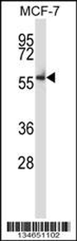 Mouse Nlk Antibody (C-term)
