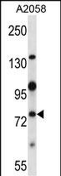 Mouse Nek8 Antibody (C-term)
