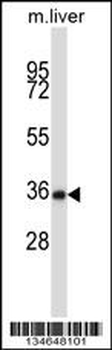Mouse Nek6 Antibody (C-term)