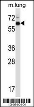 Mouse Mknk2 Antibody (N-term)
