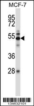 Mouse Map3k7 Antibody (N-term)