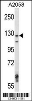 Mouse Map3k6 Antibody (N-term)