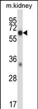 Mouse Map3k2 Antibody (N-term)