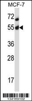 Mouse Akt2 Antibody (N-term)
