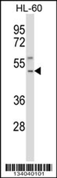 TACR1 Antibody (Center)