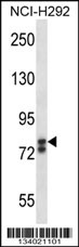 SOX30 Antibody (Center)