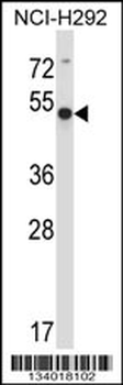 ACTR6 Antibody (C-term)