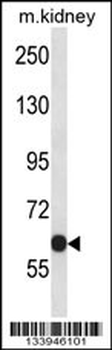 KCNC2 Antibody (C-term)
