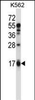 EDN2 Antibody (C-term)