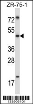MDM4 Antibody (Center)