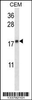 MGMT Antibody (N-term)