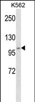 ADAMTS5 Antibody (N-term)