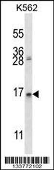 AGR2 Antibody (N-term)
