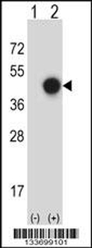XPA Antibody (C-term)