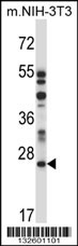 LAPTM4A Antibody (N-term)