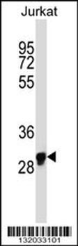 OR1N1 Antibody (C-term)