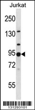 AP1G2 Antibody (N-term)