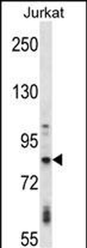 Mouse Adrbk1 Antibody (C-term)