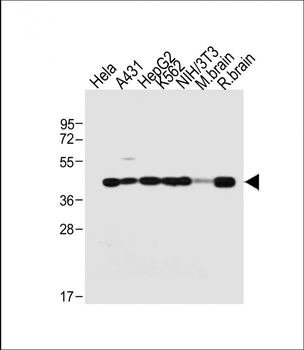 TARDBP Antibody (N-term)