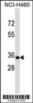 OR14C36 Antibody (C-term)