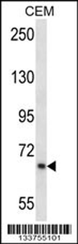 SILV Antibody (Center)