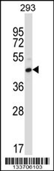 FCGR2C Antibody (C-term)