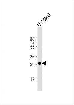 LGALS3 Antibody (C-term)
