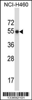 MMP8 Antibody (N-term)